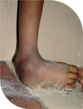Neglected cases